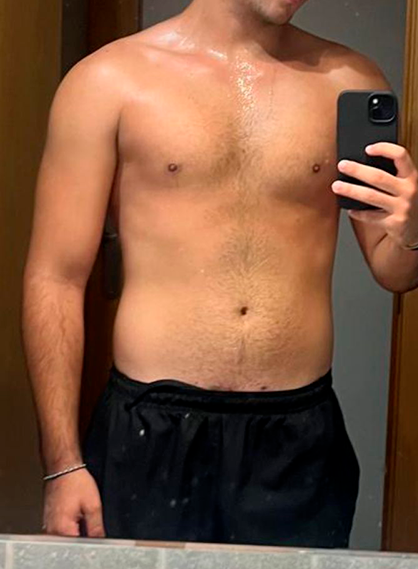 Antes