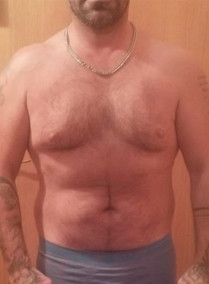 Antes